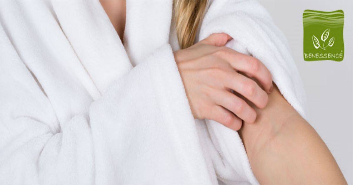 blogs posts eczema 1