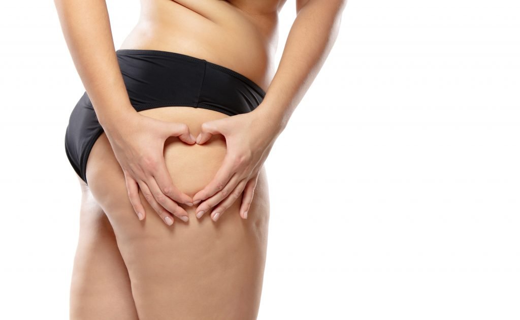 come eliminare la cellulite rimedi