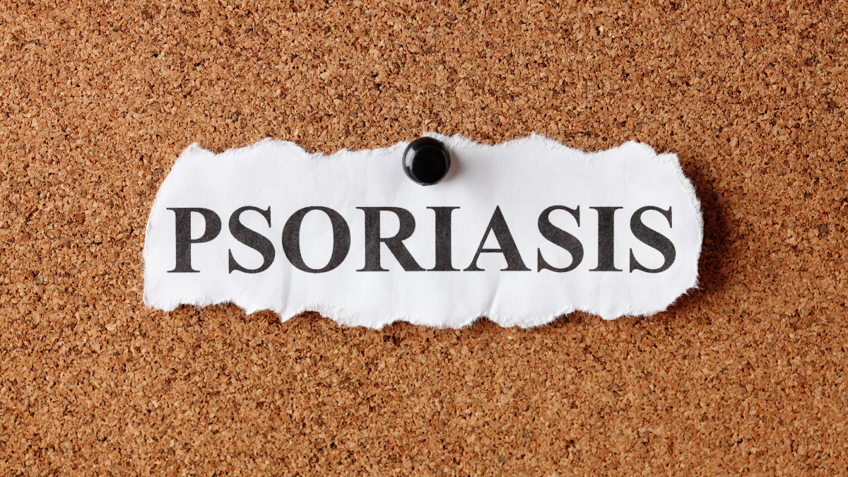 psoriasi-tipologie-sintomi